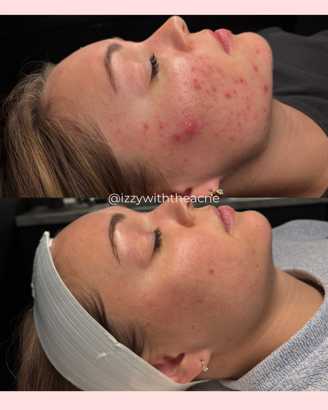 Client skin before-and-after comparison.